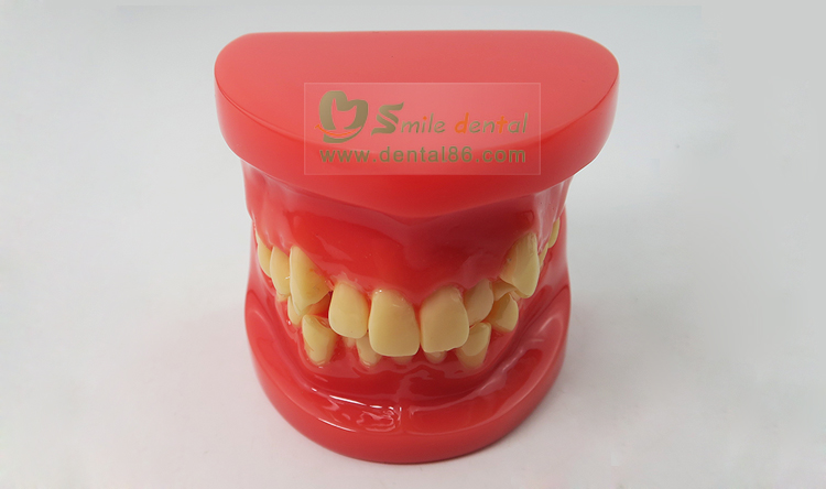 Orthodontic Model